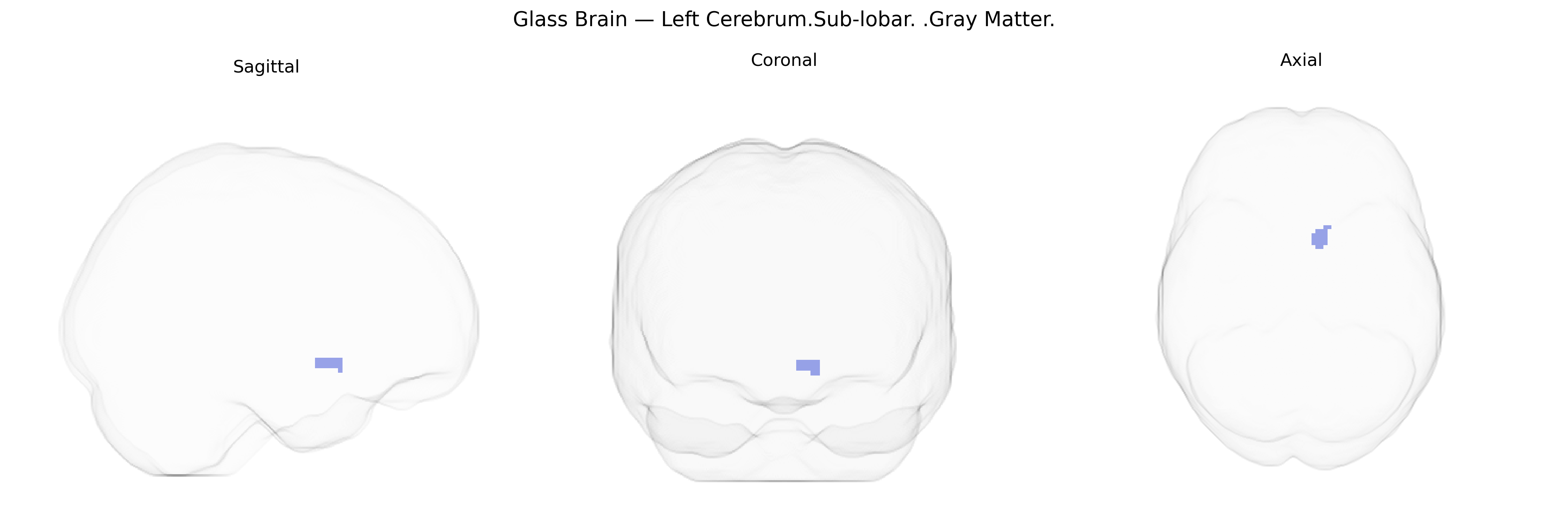 Triplanar Ghost Brain