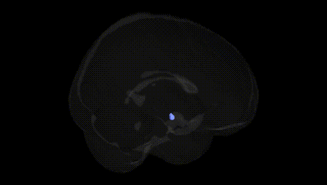 Full Brain Black