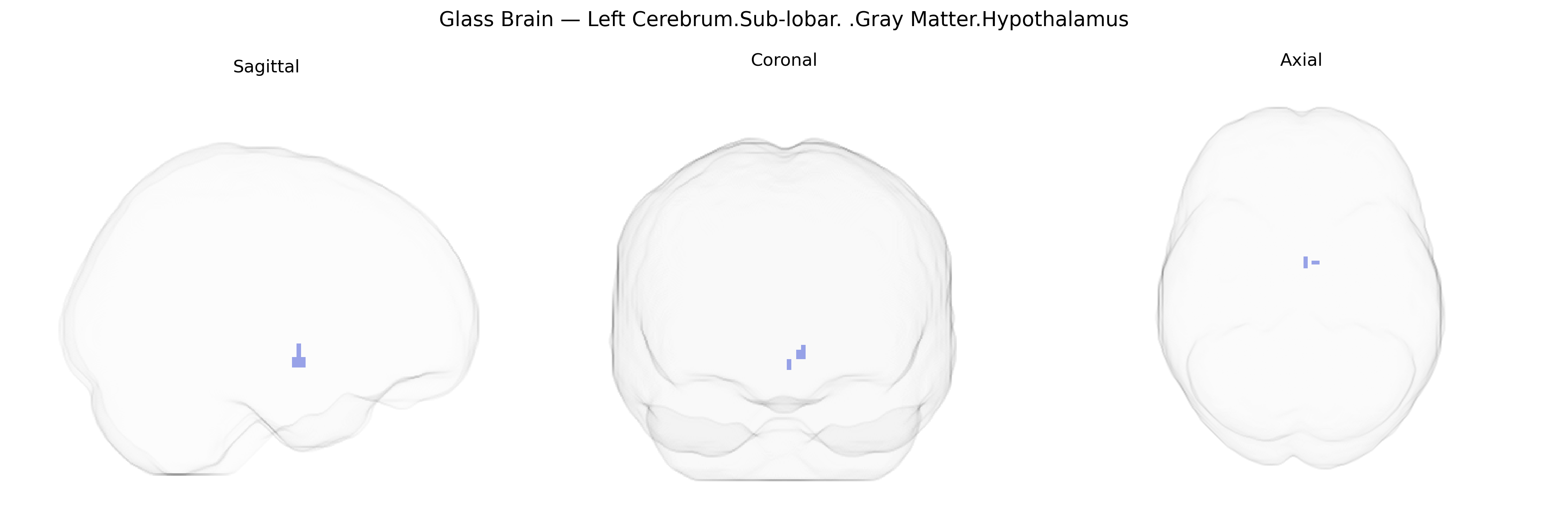 Triplanar Ghost Brain