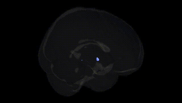 Full Brain Black