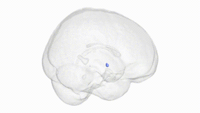 Full Brain White