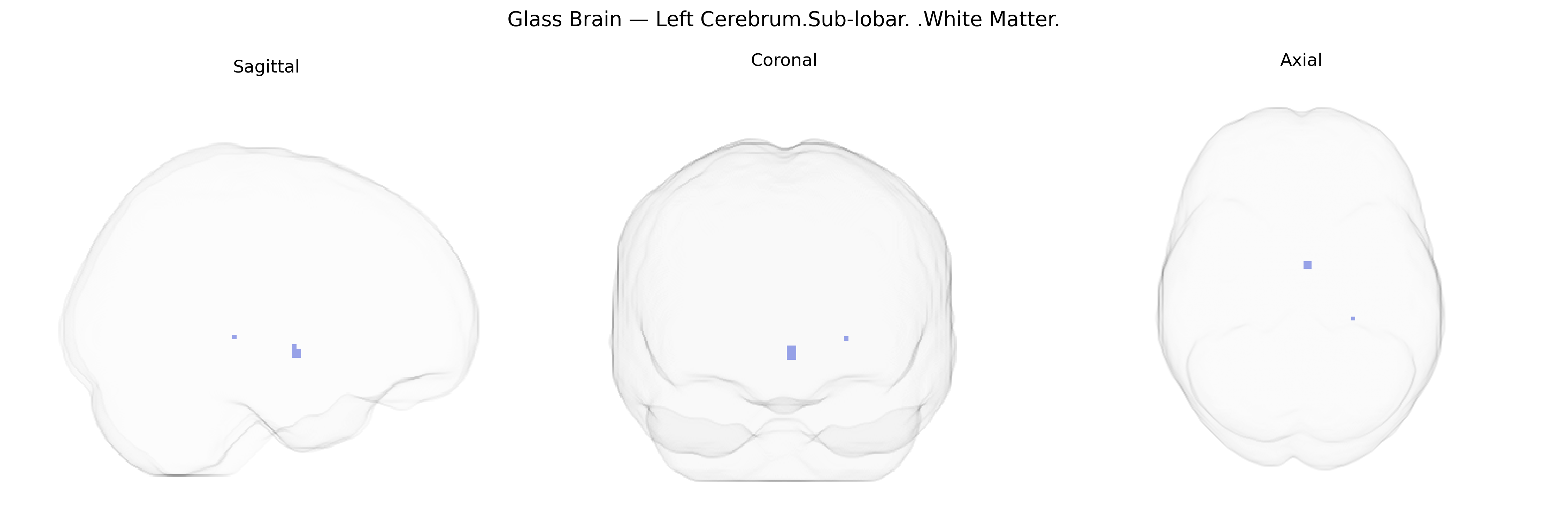 Triplanar Ghost Brain