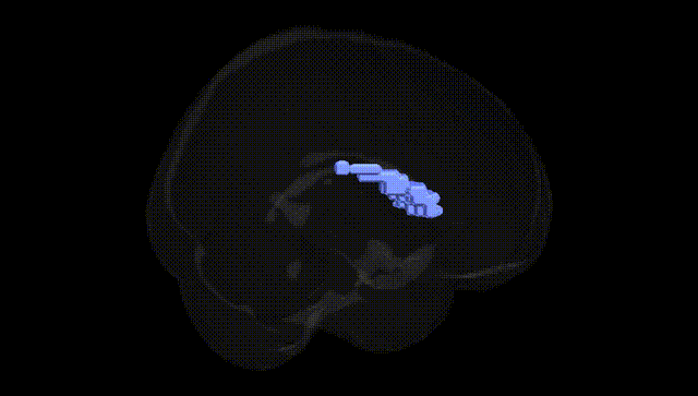Full Brain Black