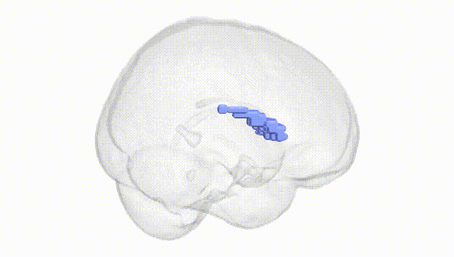 Full Brain White