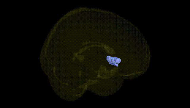 Full Brain Black