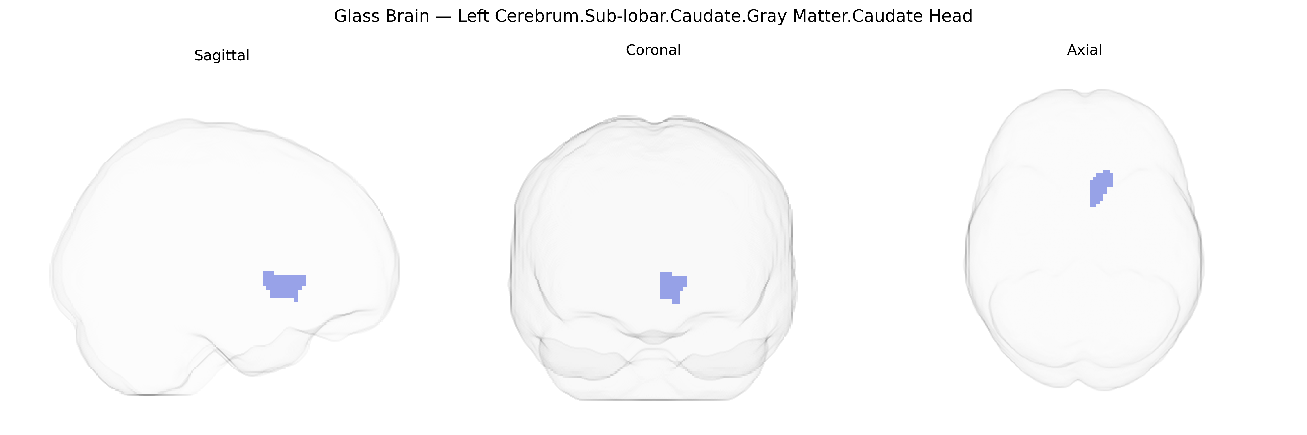 Triplanar Ghost Brain