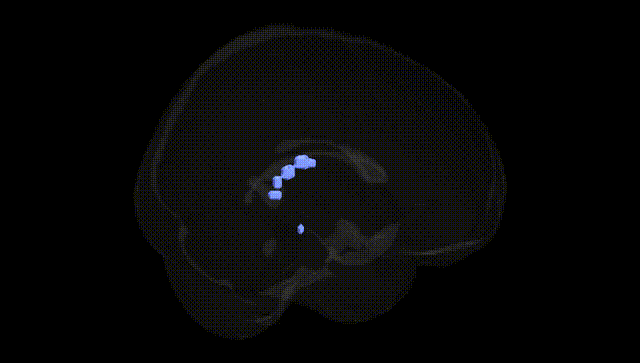 Full Brain Black
