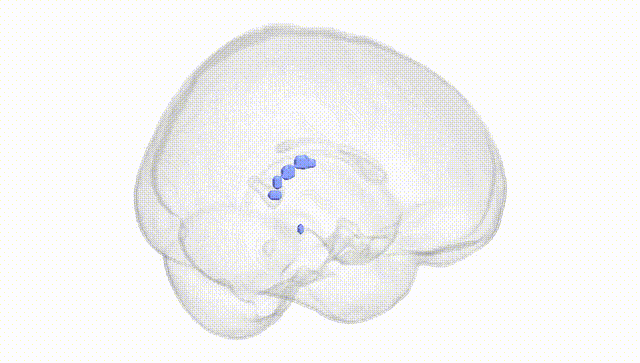 Full Brain White