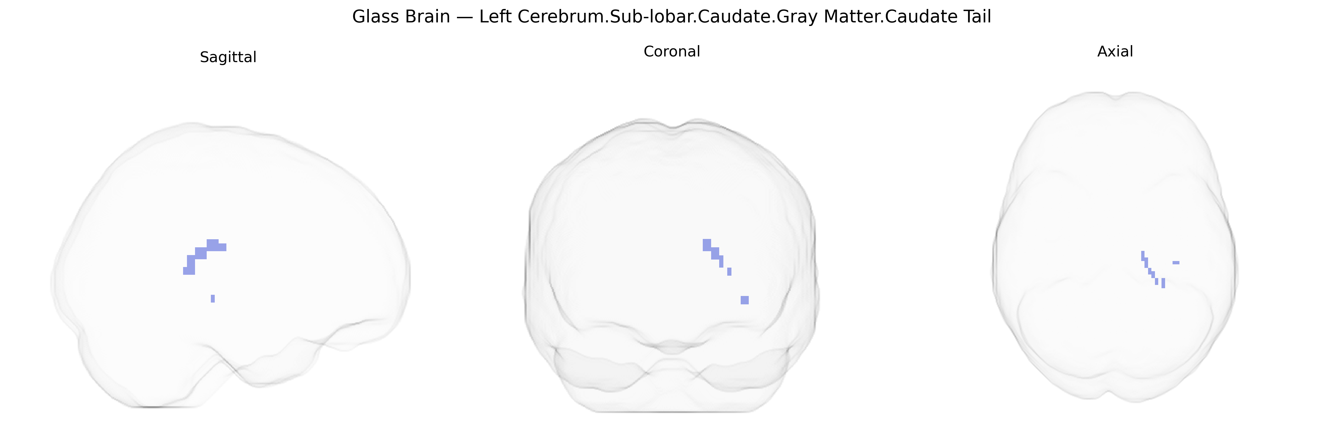 Triplanar Ghost Brain