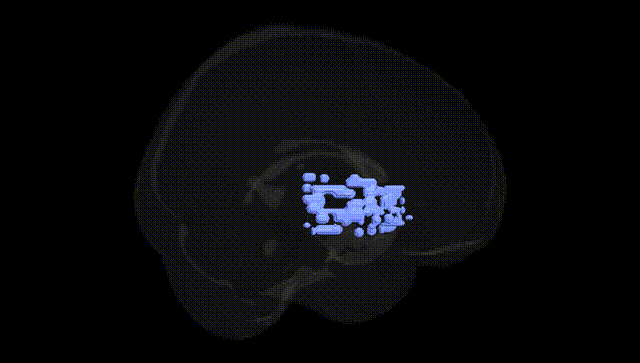 Full Brain Black