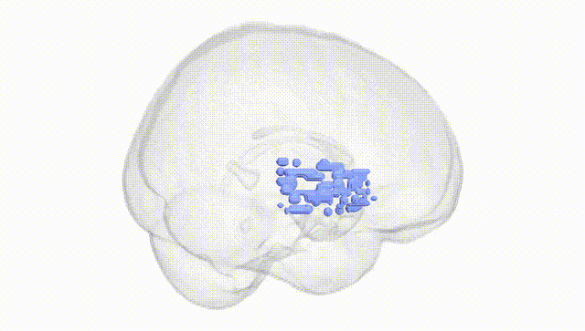 Full Brain White
