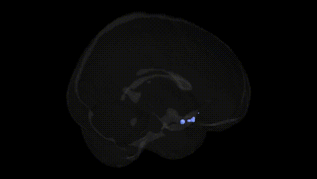 Full Brain Black