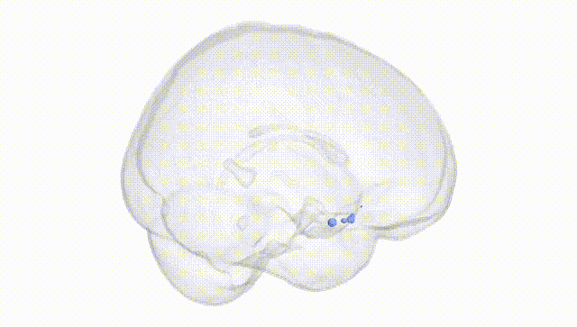 Full Brain White
