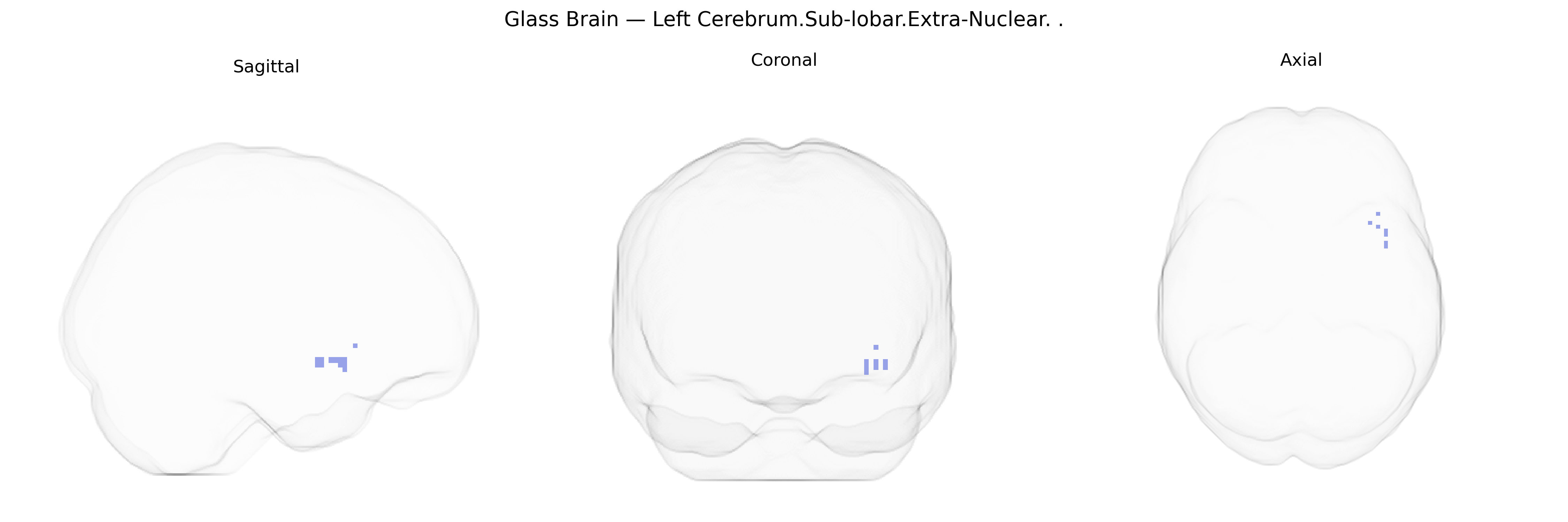 Triplanar Ghost Brain