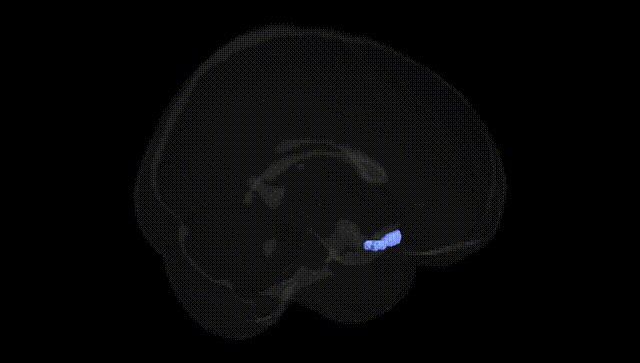 Full Brain Black