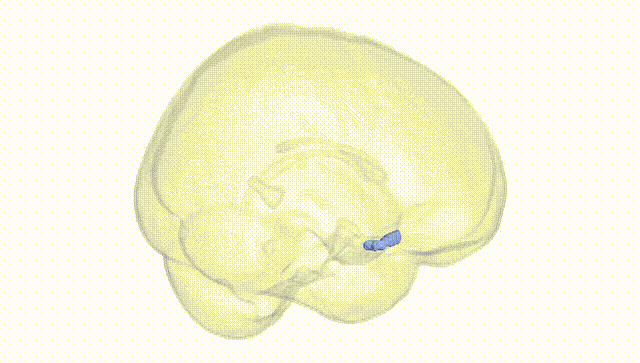 Full Brain White
