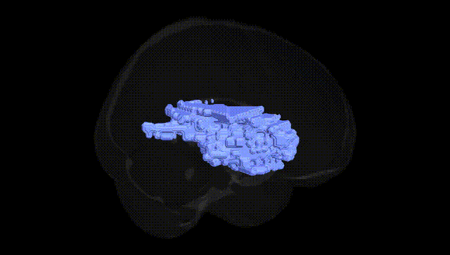Full Brain Black