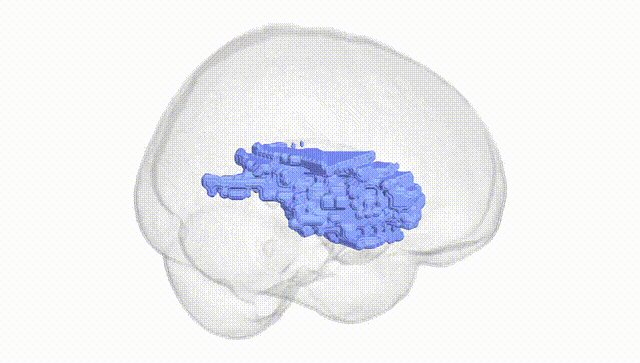 Full Brain White