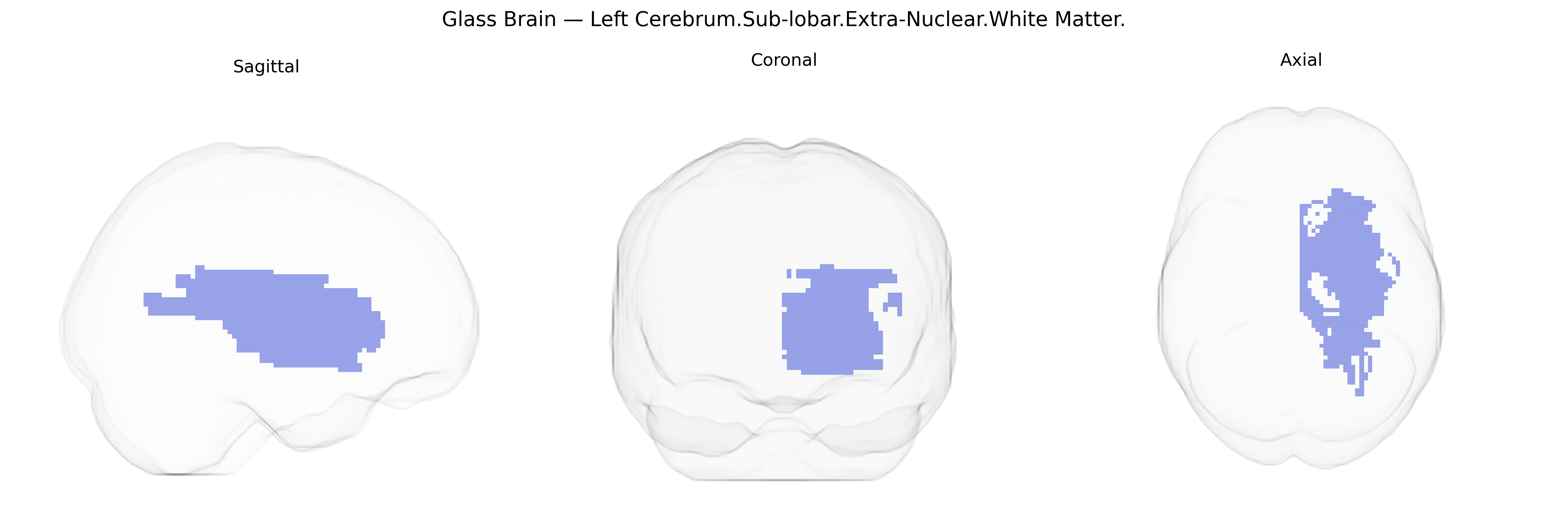 Triplanar Ghost Brain