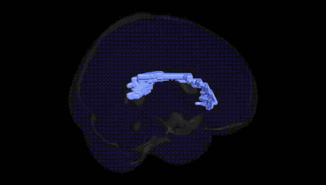 Full Brain Black