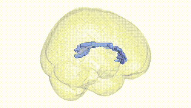 Full Brain White