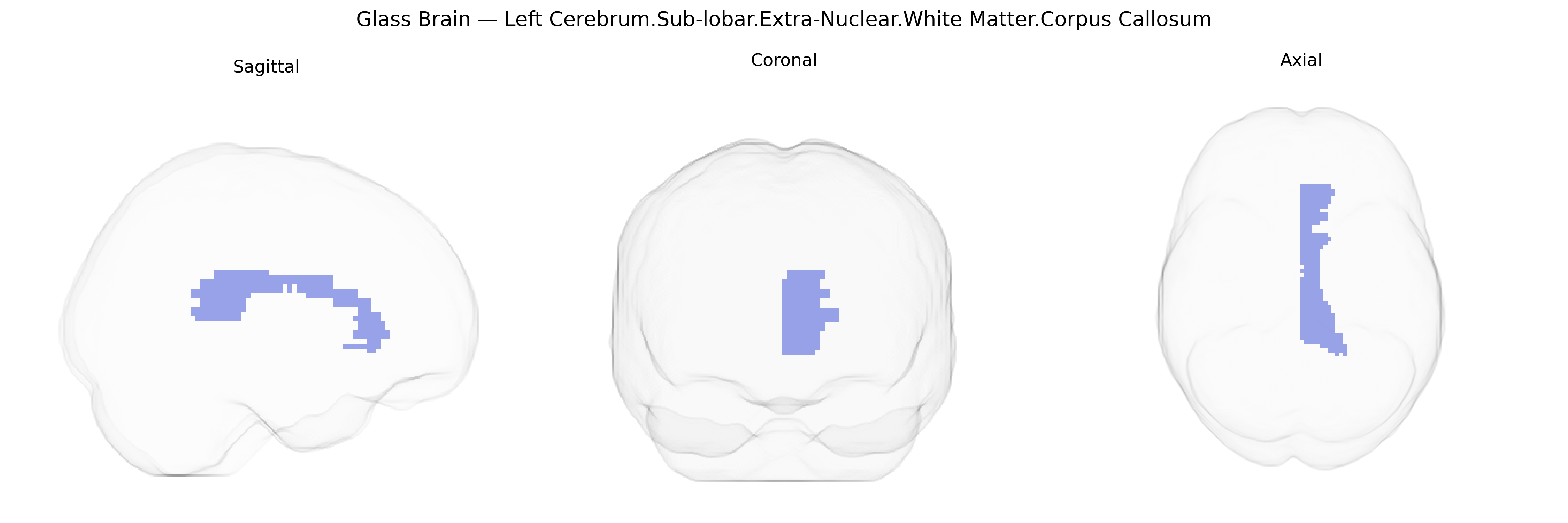 Triplanar Ghost Brain