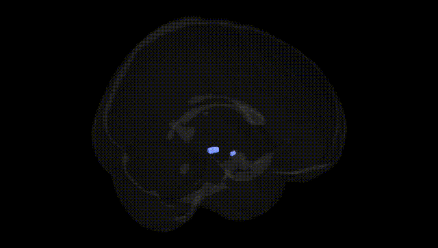 Full Brain Black