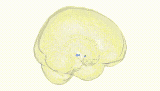 Full Brain White