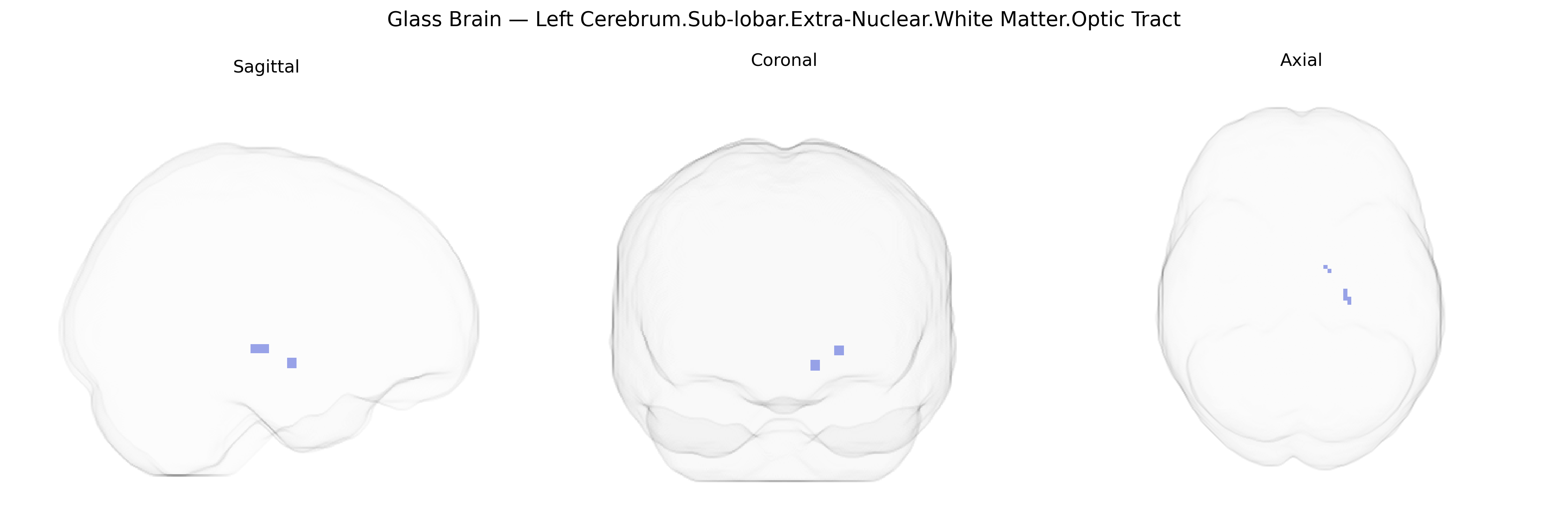 Triplanar Ghost Brain