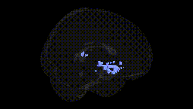 Full Brain Black