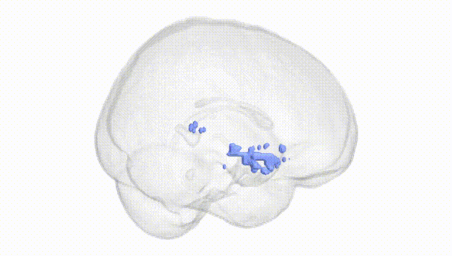 Full Brain White