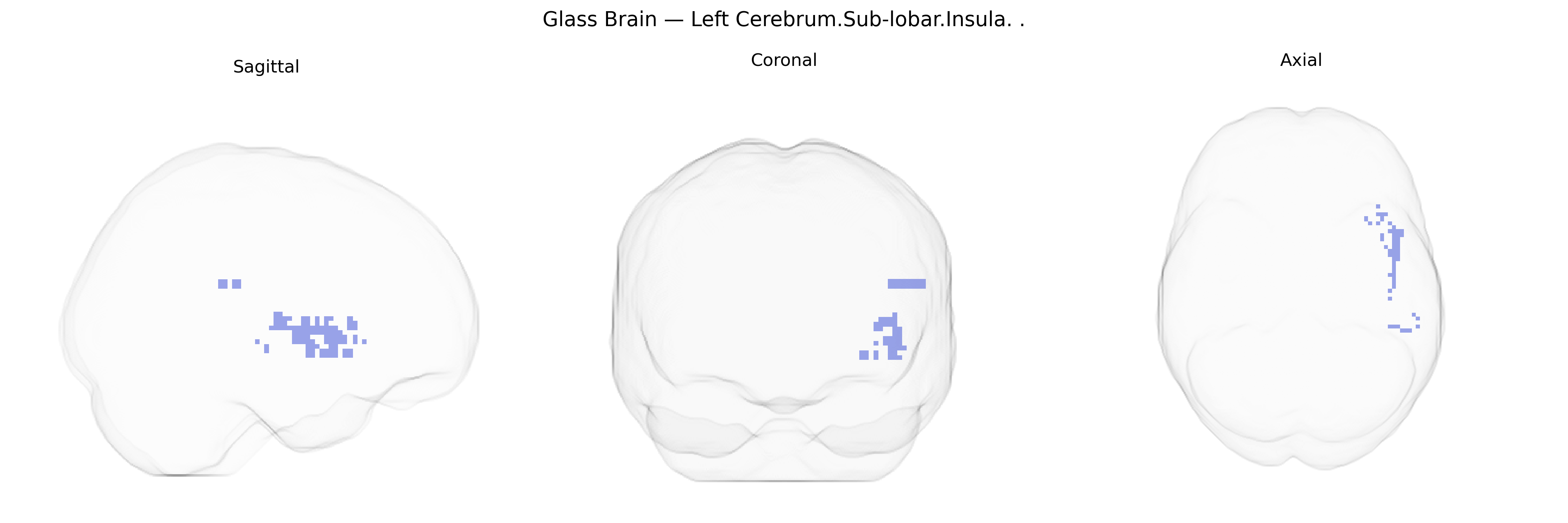 Triplanar Ghost Brain
