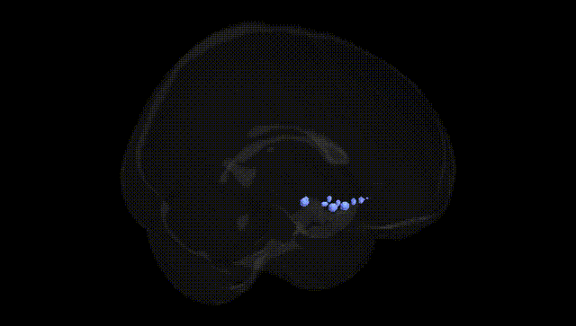 Full Brain Black