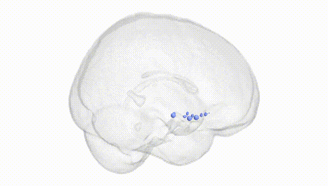 Full Brain White