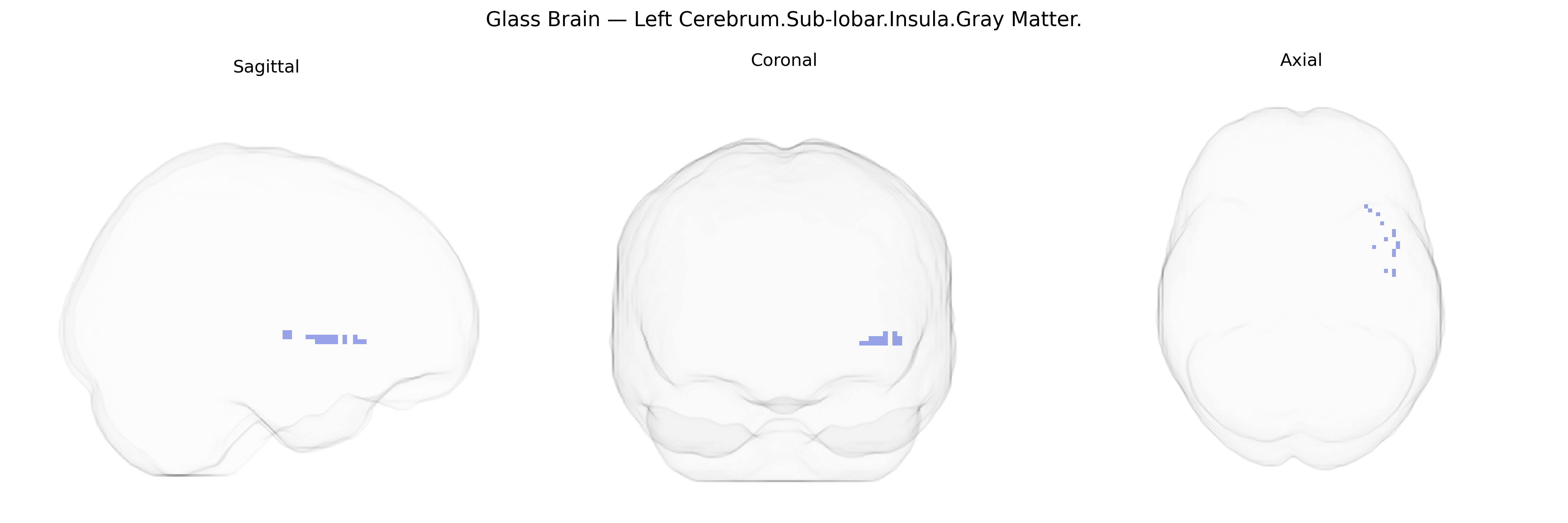 Triplanar Ghost Brain