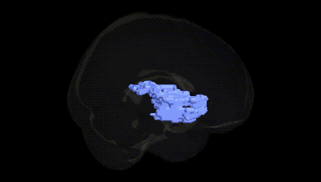 Full Brain Black