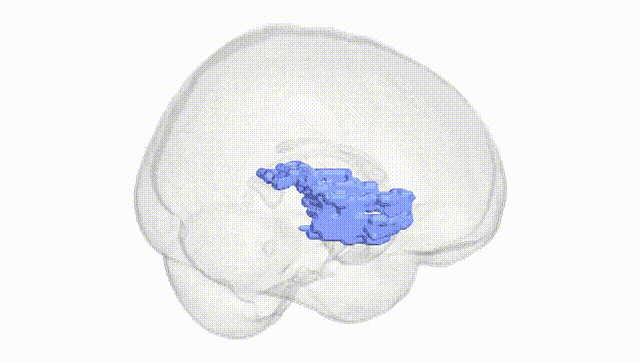 Full Brain White