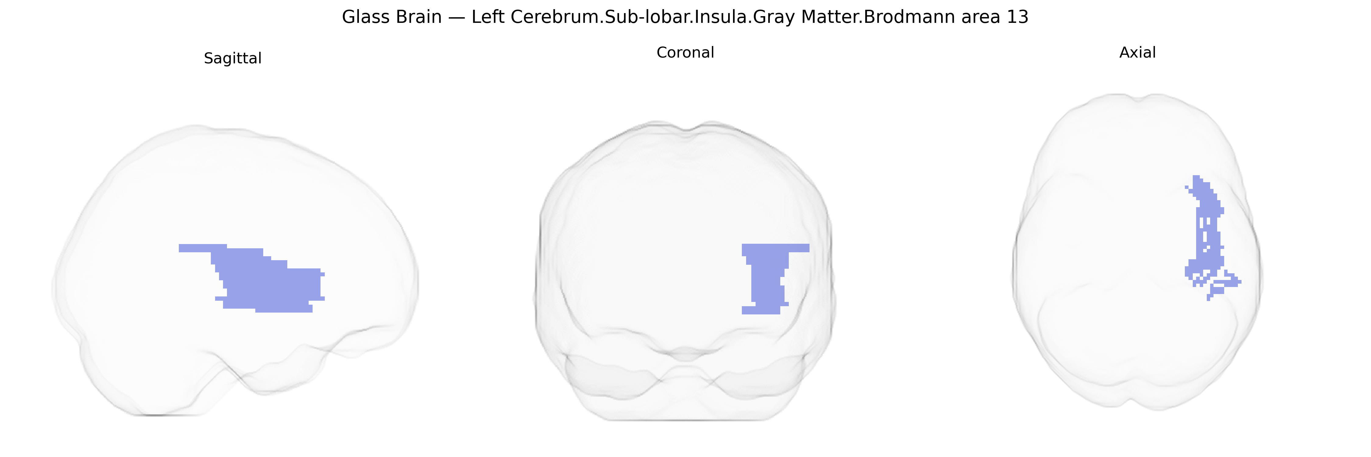 Triplanar Ghost Brain