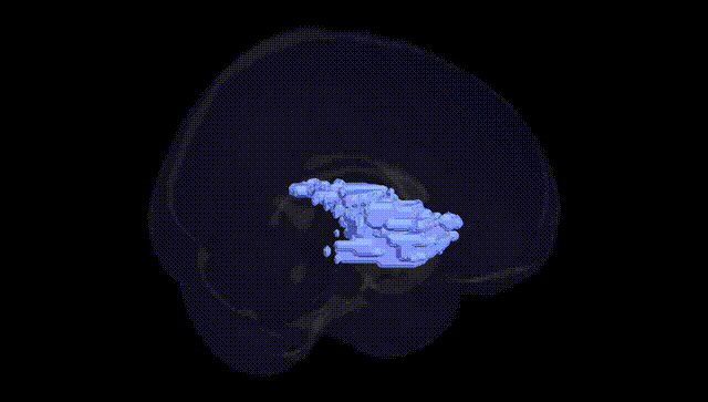 Full Brain Black