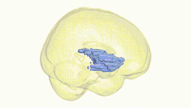Full Brain White
