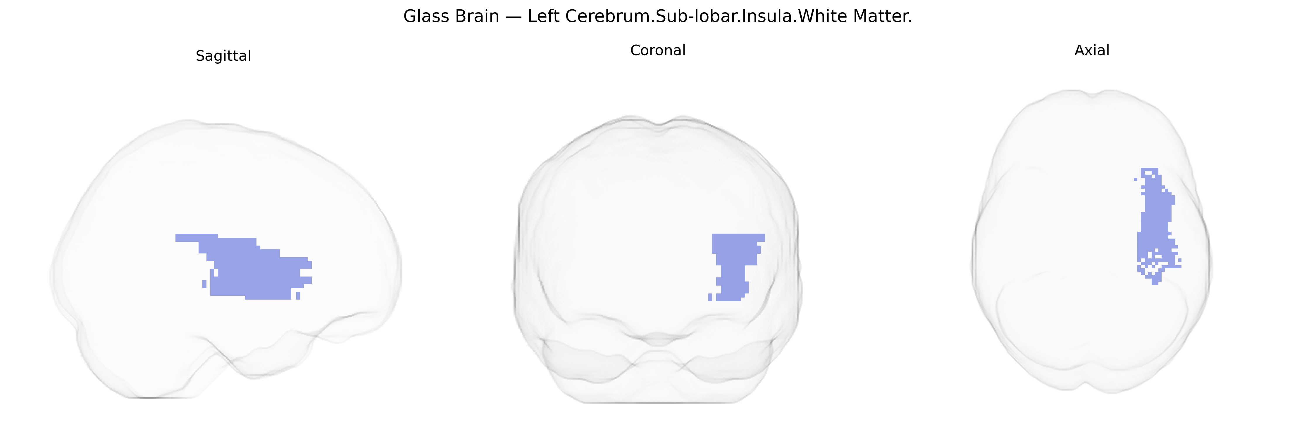 Triplanar Ghost Brain