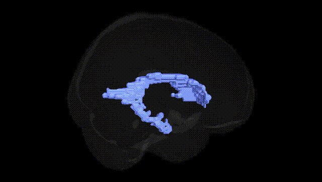 Full Brain Black