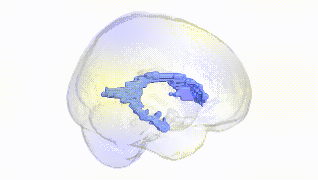 Full Brain White
