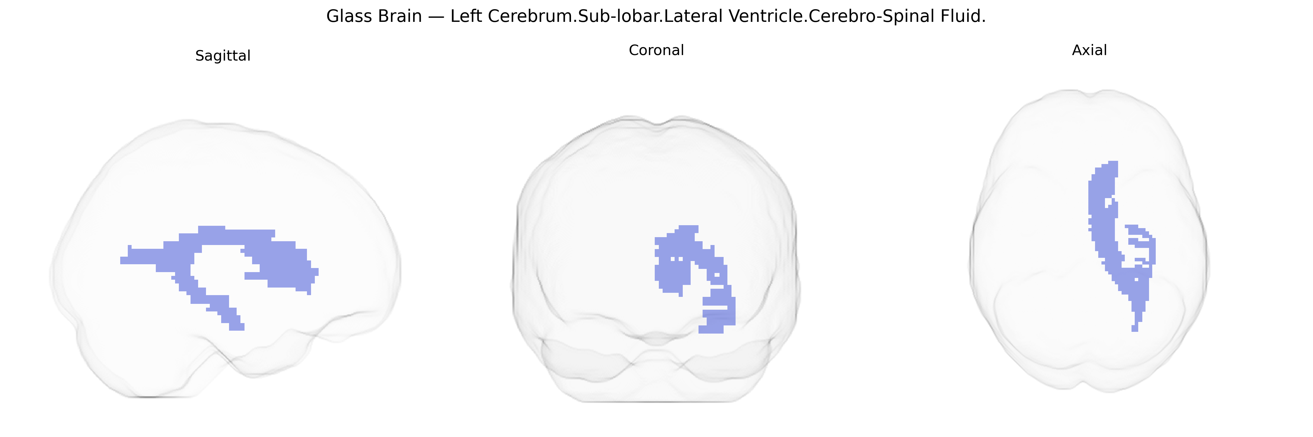 Triplanar Ghost Brain