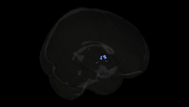 Full Brain Black