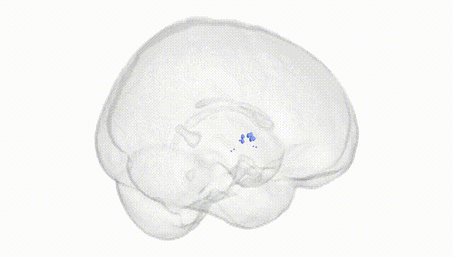 Full Brain White