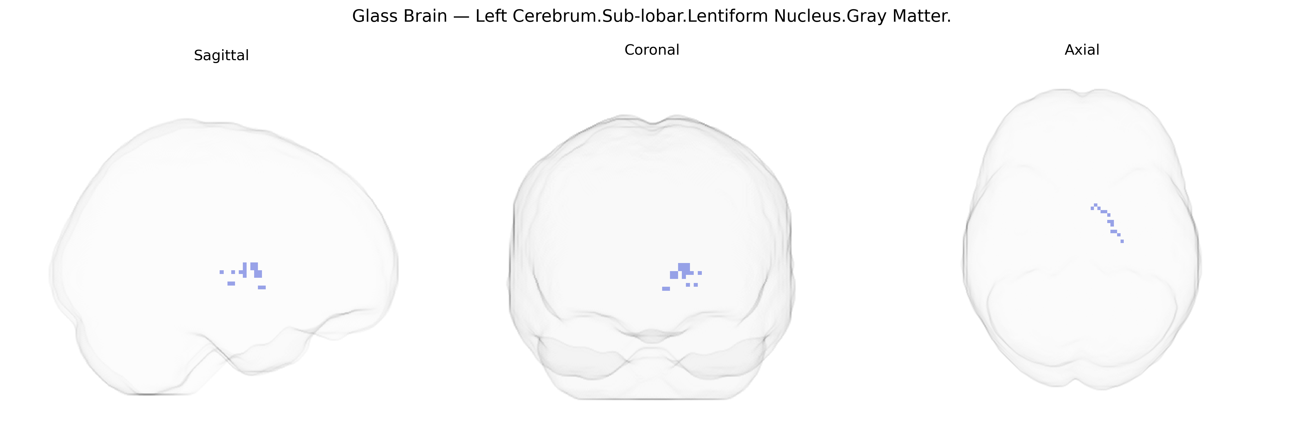 Triplanar Ghost Brain
