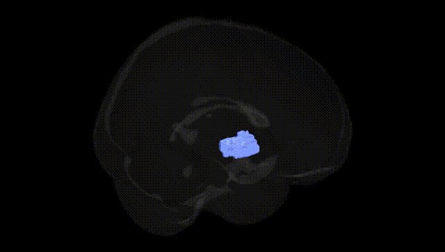 Full Brain Black