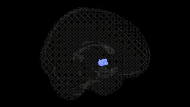 Full Brain Black