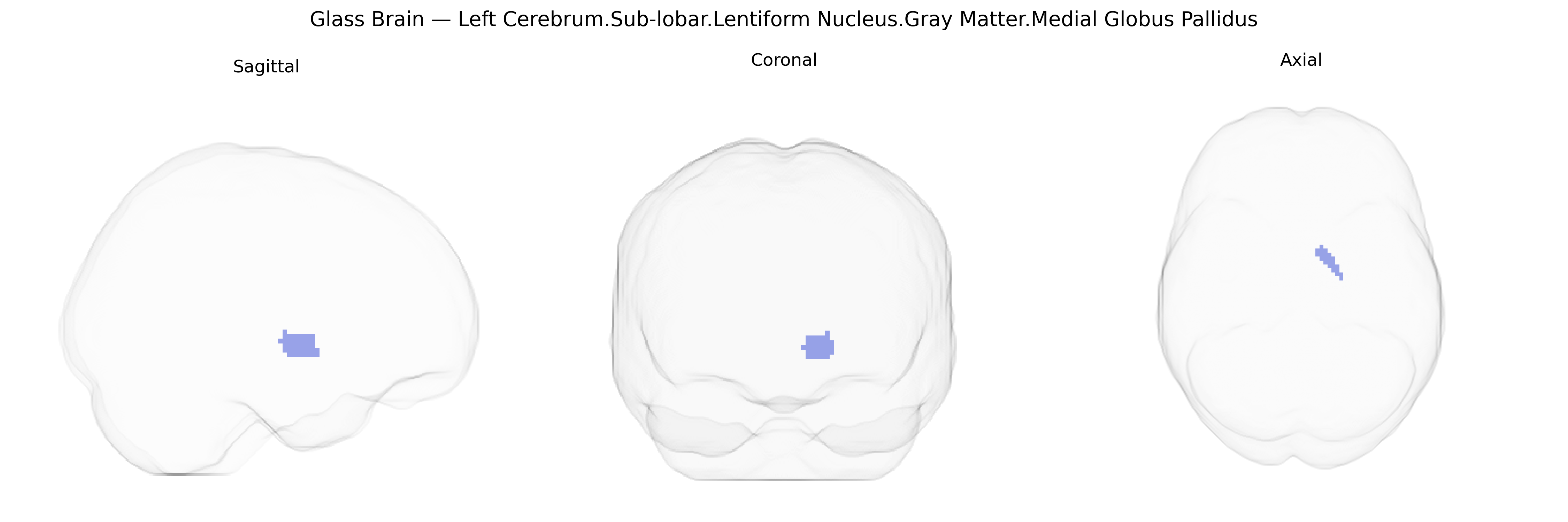Triplanar Ghost Brain